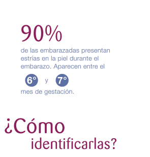 ¿Cómo identificarlas?